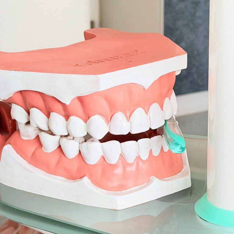 Anschauungsmodell Anschauungsmodell eines Gebisses in der Zahnarztpraxis Elfeld zur Patientenaufklärung